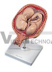 5th Month Fetus, breech position Pregnancy Model